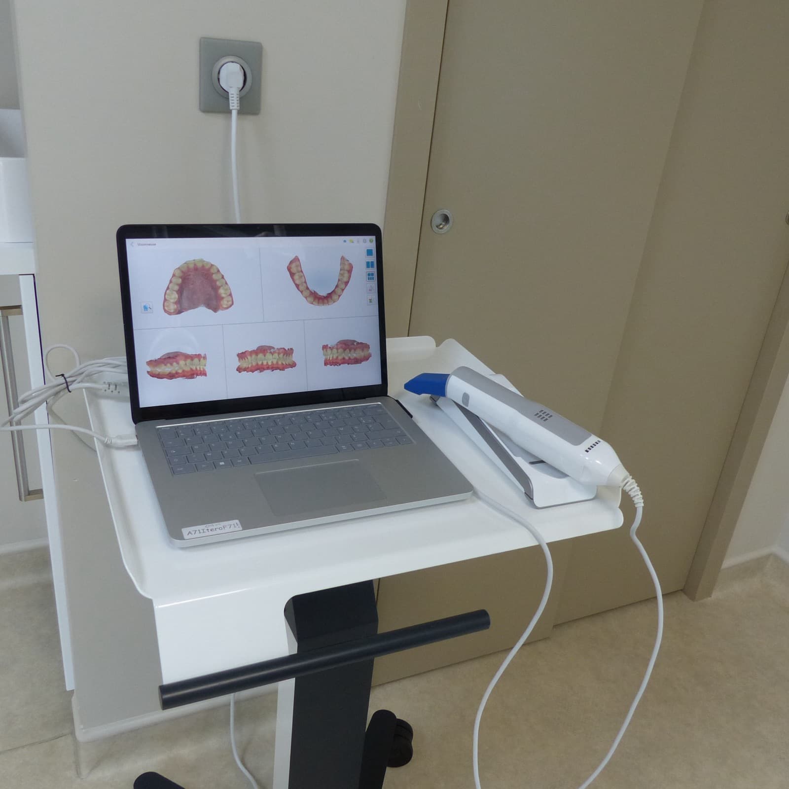 Scanner intrabuccal et ordinateur utilisés pour les empreintes numériques